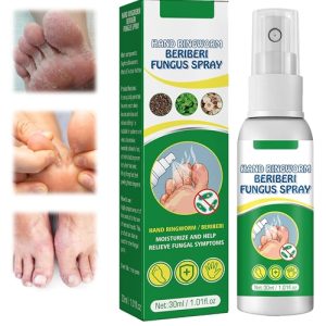 Sprej za stopala m 1 1.jpg